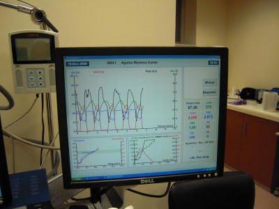 Target Maratón -  Prueba de Esfuerzo Triangular, Progresiva y Maximal sobre Cicloergómetro