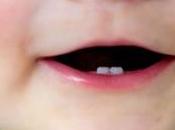 seguro dental para toda vida