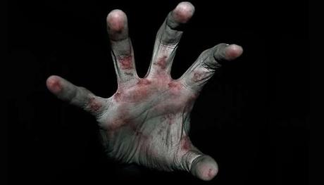 El Síndrome del muerto viviente