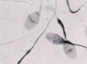 cromosoma influye producción espermatozoides