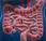 ¿Cómo prevenir formación pólipos colon?