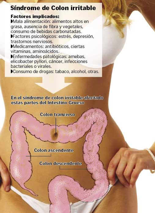 ¿Cuáles son los síntomas del síndrome del intestino irritable (SII)?