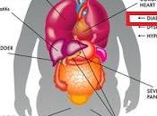 Diabesidad