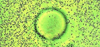 La Fecundación in Vitro