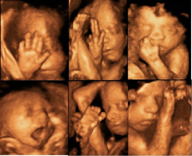 Ecografías emocionales, mira a tu bebé por primera vez en casa