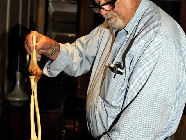 Vietnam: Médico devuelve brazo amputado 50 años después