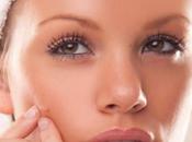 ¿Cómo prevenir brotes acné?