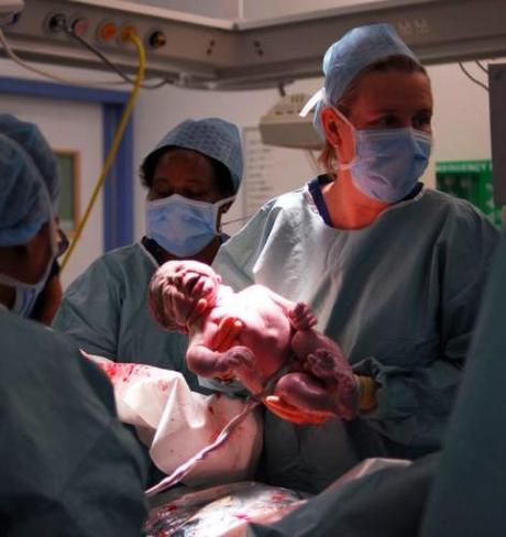 Parto inducido con fármacos y riesgo de autismo Riesgos de autismo