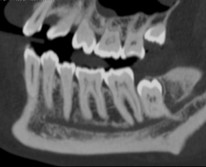 SmartSalus y TAC Dental