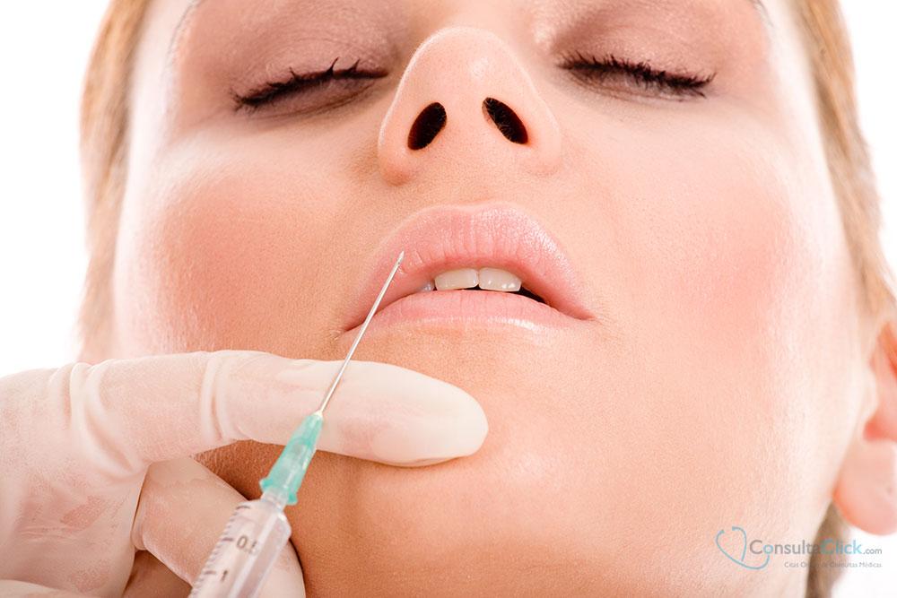 lipofilling facial
