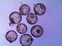 NEURONAS A PARTIR DE CÉLULAS MADRE EMBRIONARIAS