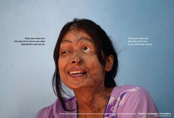 Ialsaatchisaatchi smileagain aotw