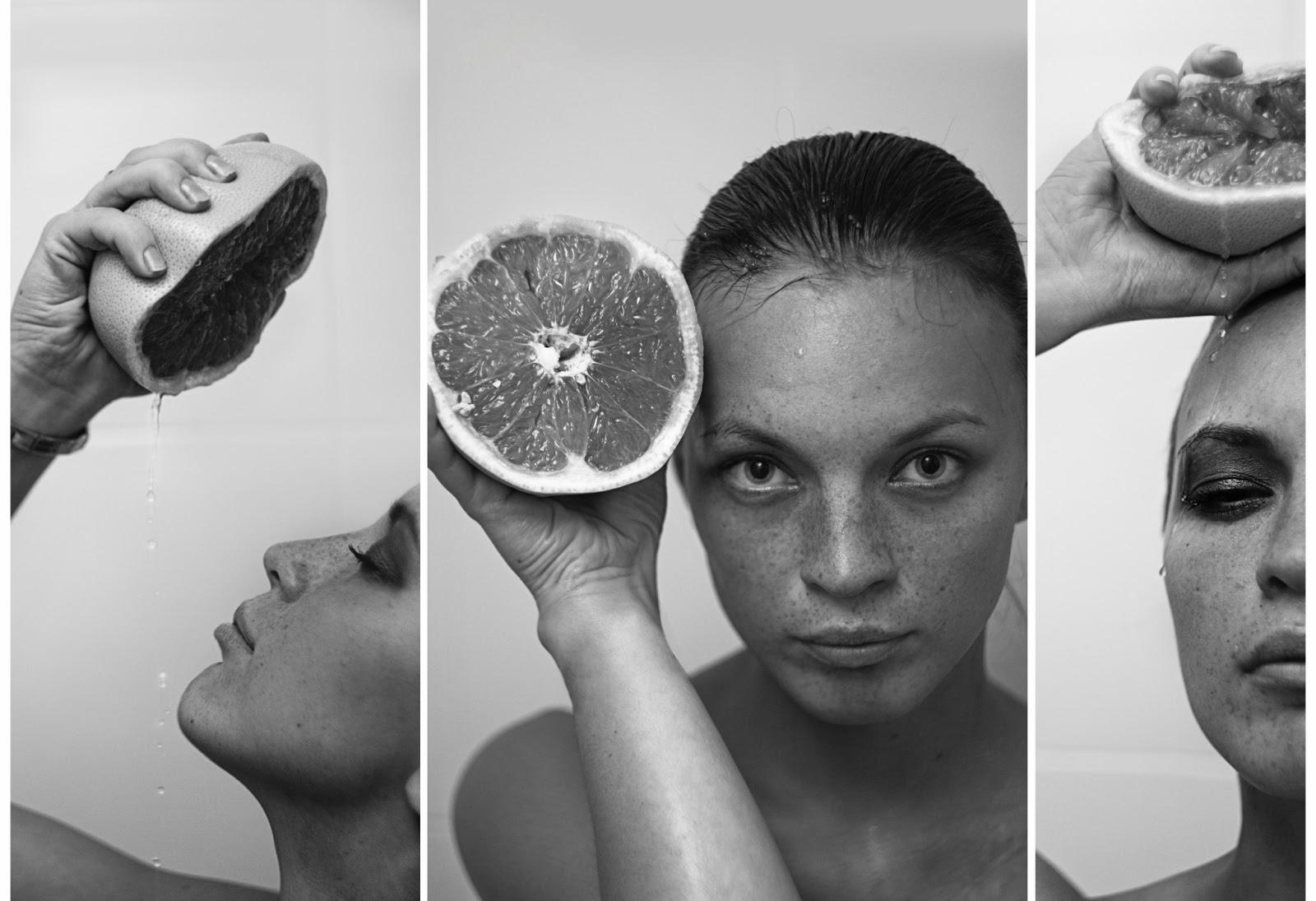 Ataques de Síndrome Creativo