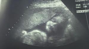 ecografia de las 30 semanas en el embarazo