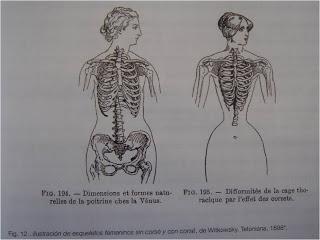 Anorexia. Ofelia+Narciso+manipulación mental = AUTODESTRUCCIÓN Anorexia. Ofelia+Narciso+manipulación mental = AUTODESTRUCCIÓN