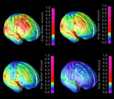 La Ciencia de la Vida: Descubierta la clave para paliar los problemas de Memoria