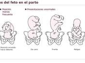 Bebé nalgas... puedo hacer!?