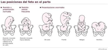 Bebé de nalgas... Qué puedo hacer!? Bebé de nalgas... Qué puedo hacer!?