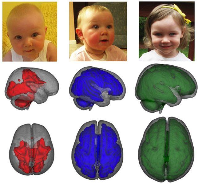 Confirman con imágenes el beneficio cerebral de la leche materna