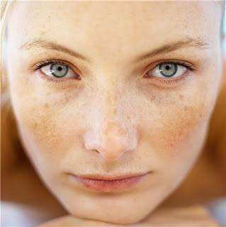 COMO ELIMINAR LAS MANCHAS FACIALES