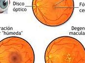 Descubre...!! Degeneración macular???