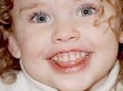 cambio dientes leche