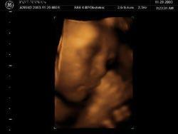 cambios en el feto en la semana 33 de embarazo