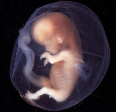 Lay del Aborto
