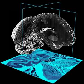 Crean el primer modelo digital del cerebro humano en 3D