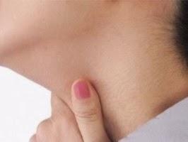 Atribuyen a Papiloma aumento cáncer boca y garganta.