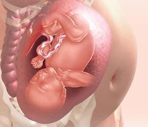 Los síntomas de la embarazada