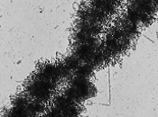 Cromátides hermanas