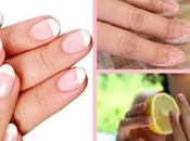 ¿Cómo eliminar manchas uñas?