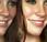 Rostro manchas