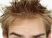 Dermatitis seborreica