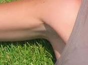 Cómo Aclarar Manchas Oscuras Axilas