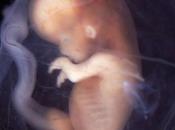 Propuesta para mostrar ecografía feto mujeres quieran abortar