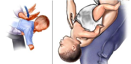 que-hacer-en-caso-de-atragantamiento-de-niños-menores-de-un-año-piensa-rapido