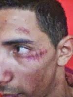 Agresión en el fútbol base canario: Los silencios cómplices tienen los días contados