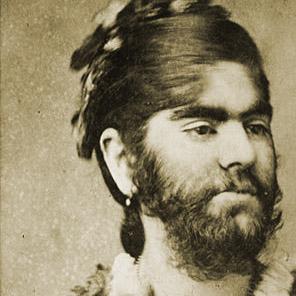 Freaks (I). Hombres lobo, mujeres barbudas y niños lanudos