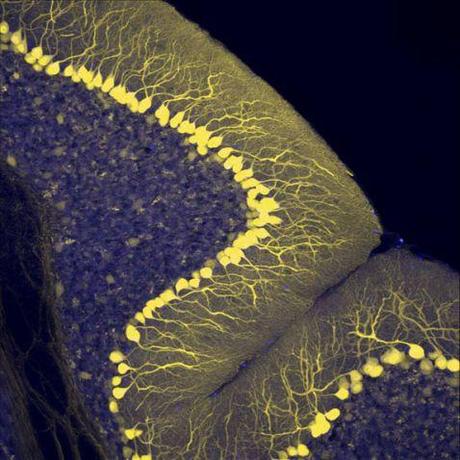 Uso de Interneuronas para Sanar la Esquizofrenia