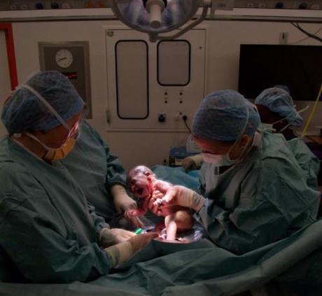 Diferenciar el parto a término Parto