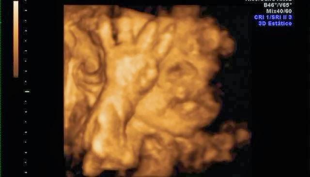 Progreso de embarazo =)