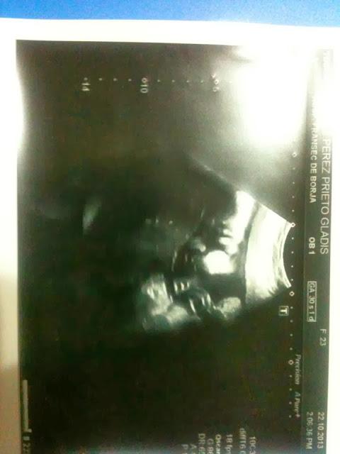 Progreso de embarazo =)