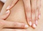 Mitos verdades sobre celulitis