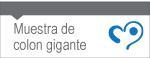 Muestra de Colon Gigante.