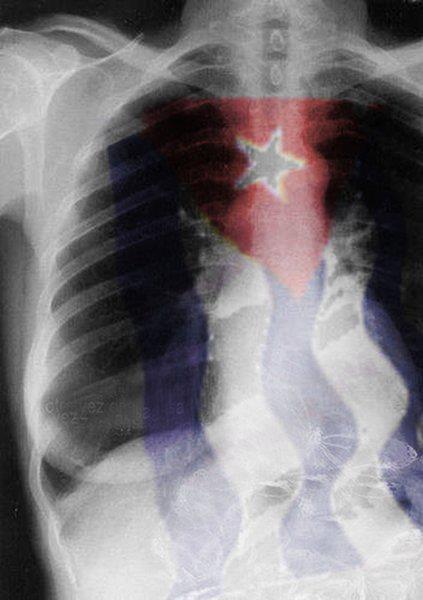 Haz clic para visitar la entrada original