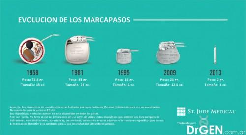 Evolucion de marcapasos 500x275 Evolución de los Marcapasos y un nuevo marcapasos Nanostim