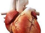 factores riesgo debido insuficiencia cardíaca
