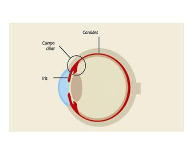 Esquema de la afectación del ojo en la uveitis